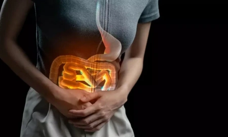 Cirurgia na Doença de Crohn: quando a ressecção intestinal é necessária