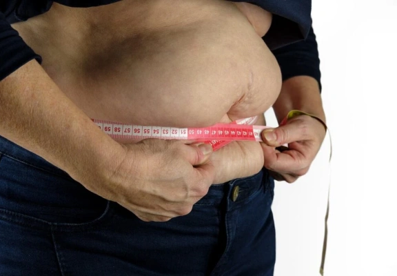 Por que a cirurgia bariátrica vai além da perda de peso?